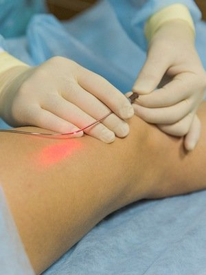Laser treatment